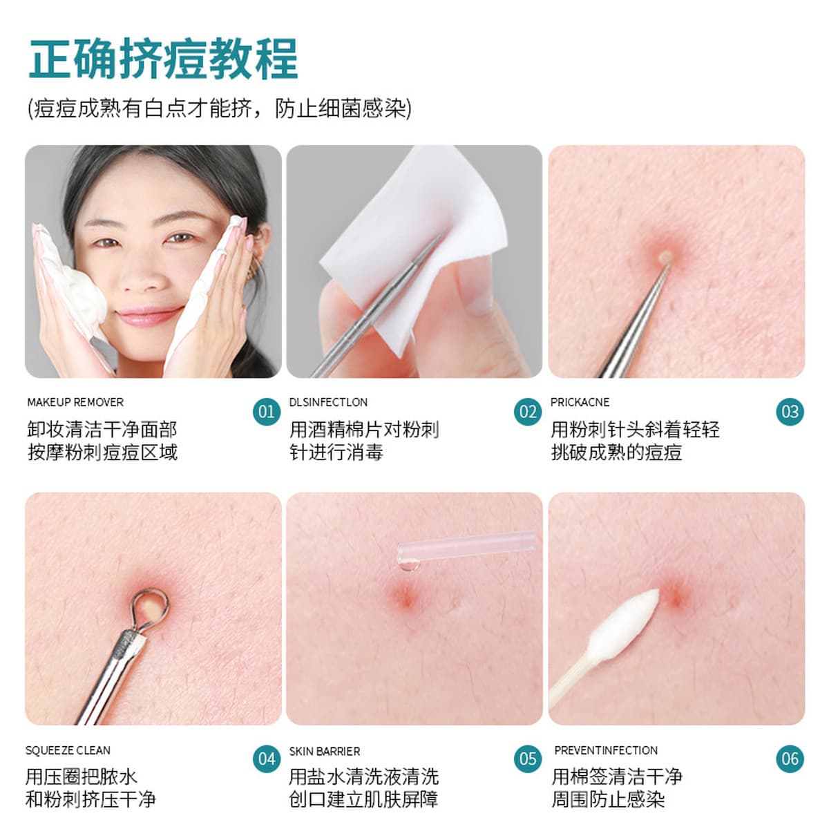 GECOMO нержавеющая сталь акне игольчатый костюм игла от прыщей зажим для прыщей Пинцет косметический инструмент зажим для...